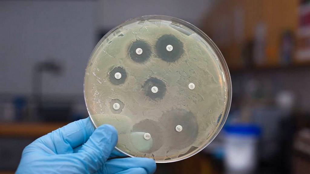 Ujian Mikrobiologi - Ujian Keberkesanan Antibakteria, Antimikrobial