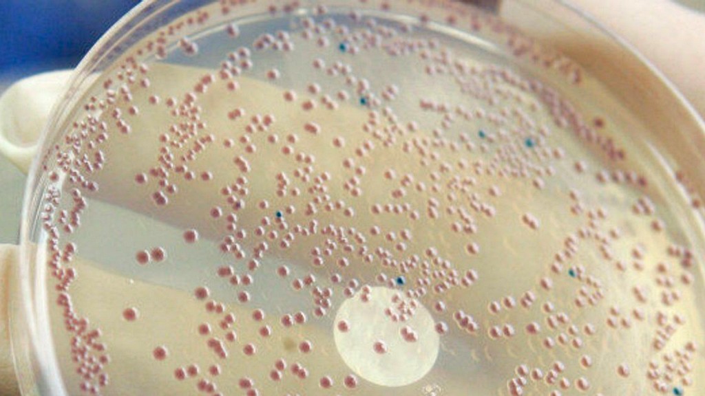 Ujian Mikrobiologi - Escherichia Coli (ISO 21150)