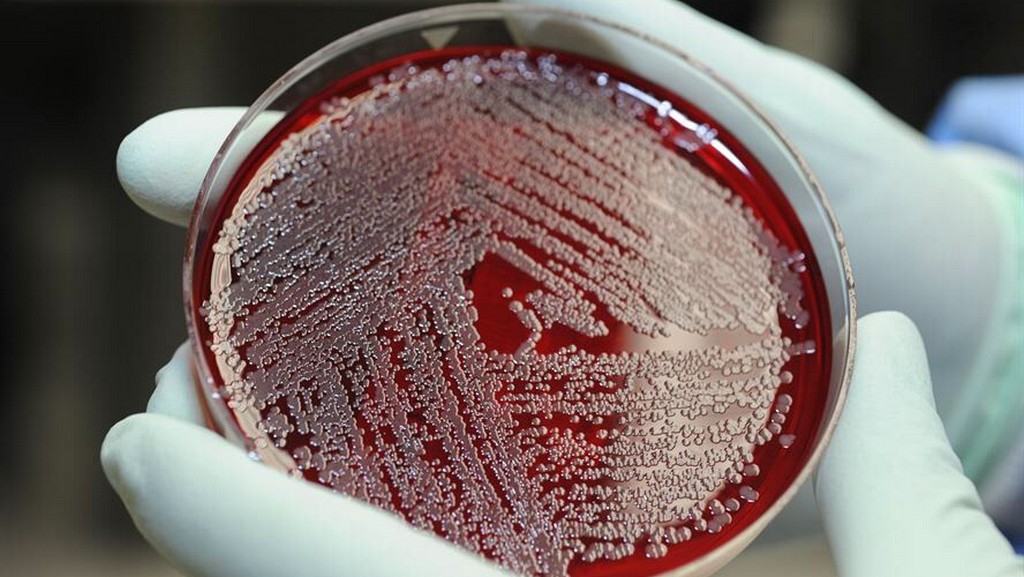 Ujian Mikrobiologi - Pseudomonas Aeruginosa (ISO 22717)