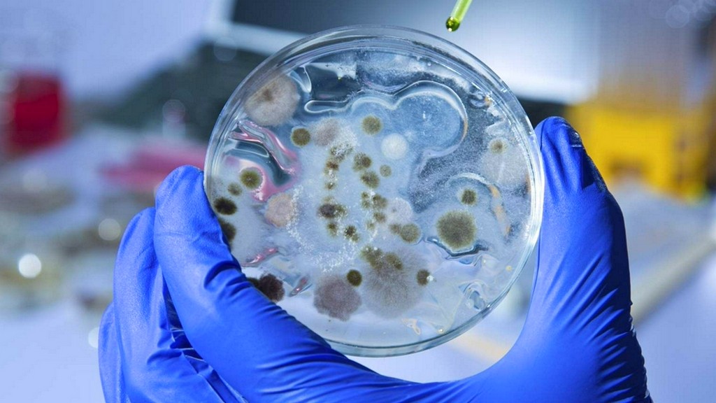 Pruebas de microbiología: recuento total de hongos y levaduras (ISO 16212)